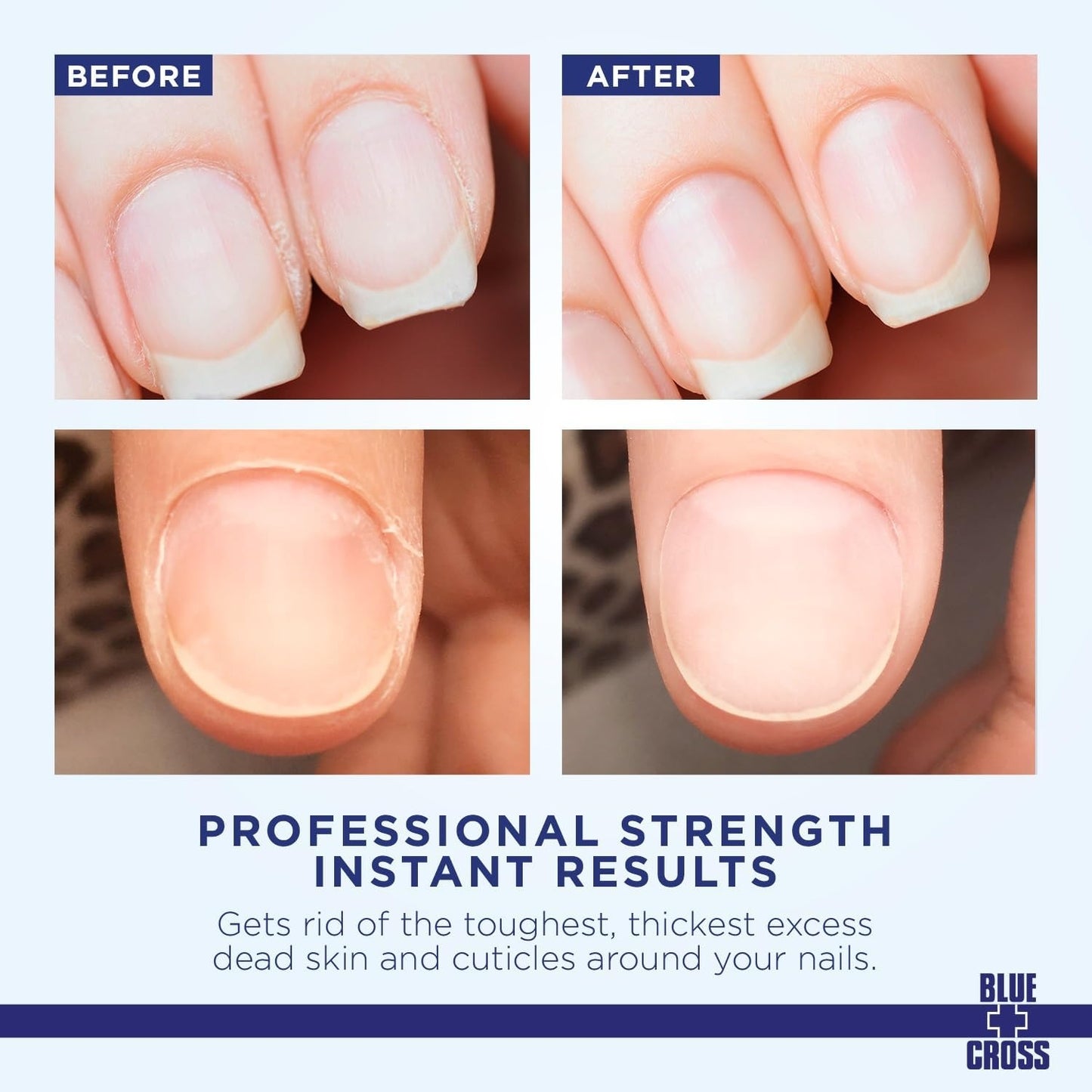 Blue Cross Cuticle Remover lanolin cuticle care bottle for nail prep before and after