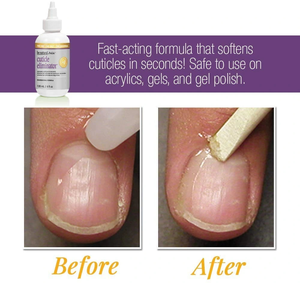 Cuticle softener Canada Prolinc eliminator removing overgrown cuticles quickly