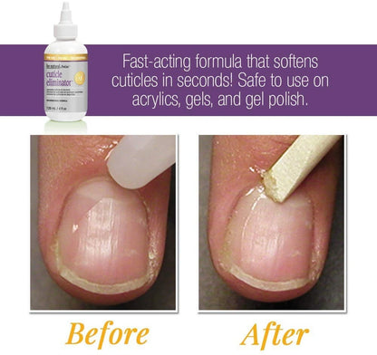 Cuticle softener Canada Prolinc eliminator removing overgrown cuticles quickly