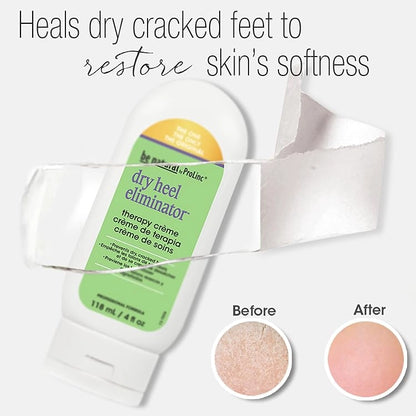 Dry heel cream for foot repair professional salon and at-home use Canada