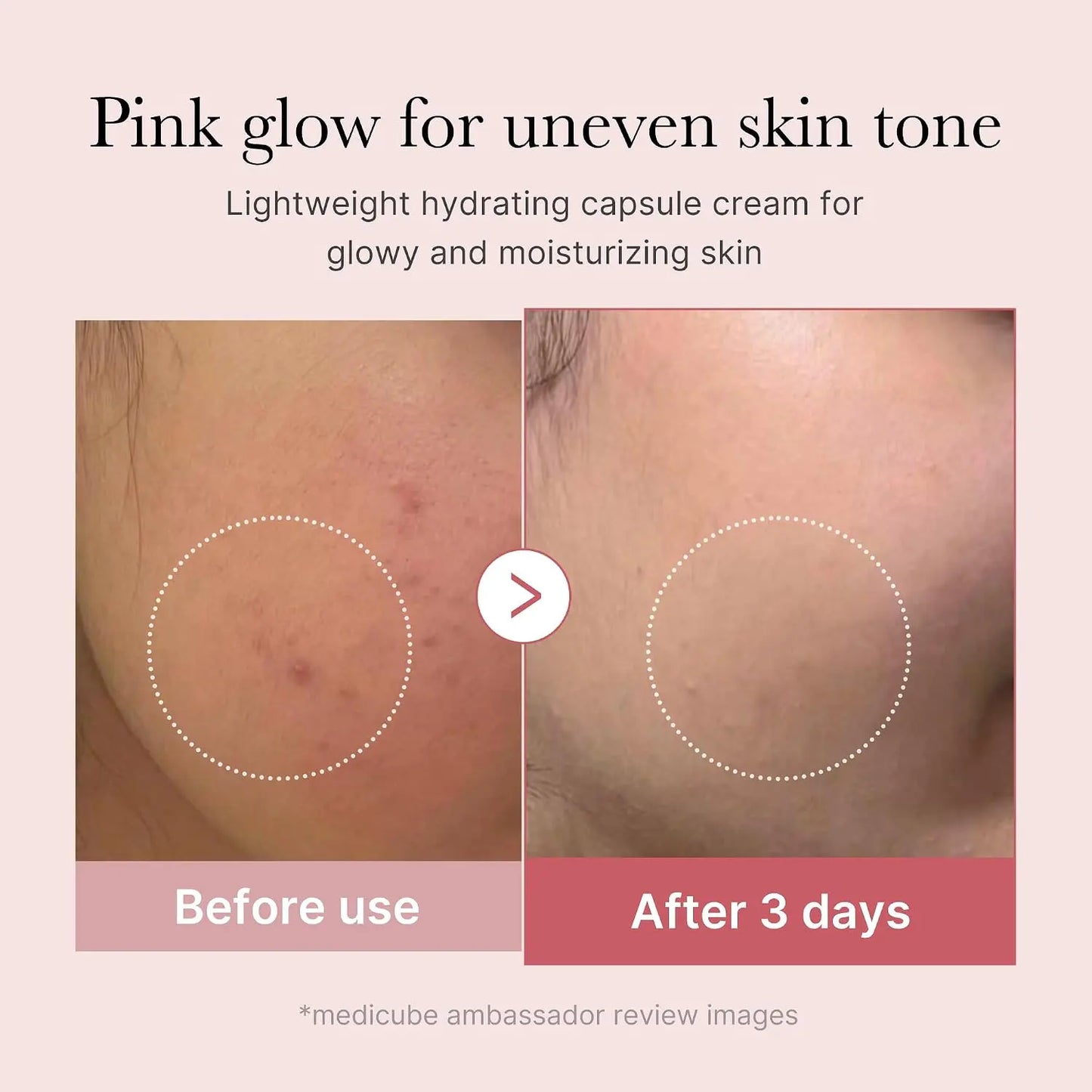 Before and after comparison of skin tone improvement with Medicube PDRN Pink Collagen Cream