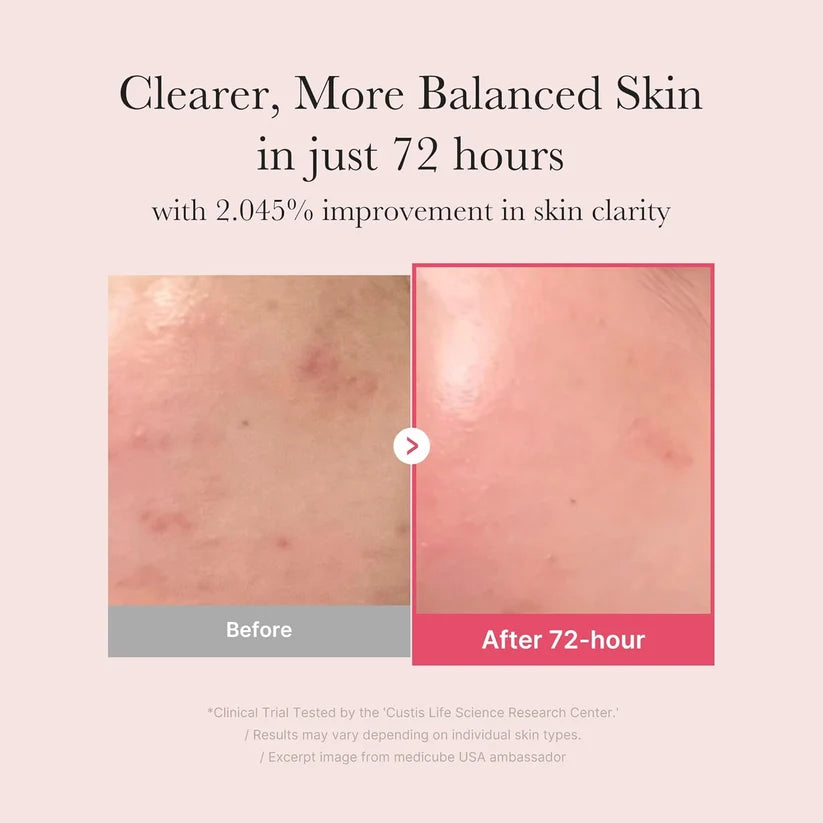 Before and after comparison for Medicube TXA Niacinamide 15 Serum